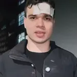 ВИДЕО: Пребитият Пело Кръстев: Имам 7 шева на главата, откраднаха ми телефона