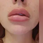 Свещеник: Изкуствената красота на момичетата води до депресия и смърт