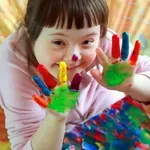 Революция: Медици „заглушиха“ гена, предизвикващ Синдрома на Даун