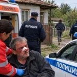Изверг премаза от бой баща си и избяга, полицията го издирва