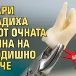 Медицински феномен: Лекари извадиха зъб от очната кухина на 16-годишно момче