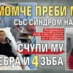 Небивала жестокост: Момче преби мъж със синдром на Даун, счупи му 6 ребра и 4 зъба