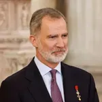 Оперираха краля на Испания от перде на окото