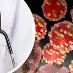 ПРОФ. КАНТАРДЖИЕВ: Случаите на морбили нарастват, ваксинацията е ключът срещу разпространението!