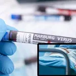 ИДВА ЛИ НОВА ОПАСНОСТ? Пламна огнище на една от най-смъртоносните болести!