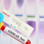 НЕВИЖДАНА НАГЛОСТ: Обвиниха бивш депутат в производство на фалшиви COVID тестове!