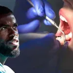 Левски праща Фабиен на зъболекар