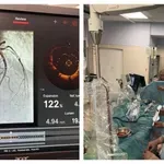 МЕДИЦИНСКИ ПРОБИВ: Спасиха пациент с вкаменени съдове!