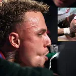 Ужасяващо: Играч загуби част от пръста си в ШЛ (видео)