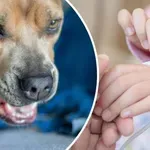 Агресивно домашно куче нахапа дете!