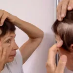 Как да спрем косопада? Правилното хранене помага!
