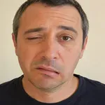 БОЛКАТА – предвестникът на фациалиса