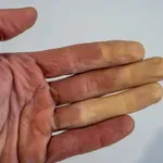 So take roke pozimi normalne?