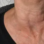 Otekanje nog in prebavne težave so lahko tudi znaki tega raka