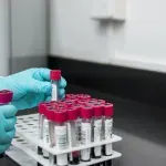 Napredni test krvi za više od 50 vrsta raka pokazao obećavajuće rezultate