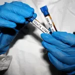 Doktorica Selimović-Hamza za N1: Ovo nije novi COVID, hantavirus na Balkanu je skroz drugo oboljenje