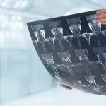 Naučnici sa Stanforda pronašli način za obnovu hrskavice: Veliki preokret u liječenju osteoartritisa