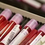 (VIDEO) Zavod za javno zdravstvo FBiH: Virusni hepatitisi, tiha prijetnja javnom zdravlju