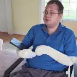 Muškarac rođen sa "sindromom leptira" opisao simptome teške rijetke bolesti