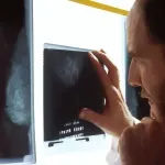 Rak koji se ne može operirati: Razloga za to je mnogo, evo koje su druge opcije