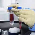 Nova šansa za hematološke onkološke bolesnike: U Hrvatskoj počinje proizvodnja CAR-T terapije