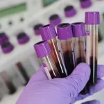 Preokret u borbi protiv raka: Ovaj test otkriva 50 vrsta godinama prije simptoma