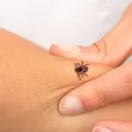 Koliko dugo krpelj mora da bude pričvršćen za kožu da biste se zarazili?