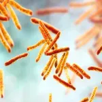 Tuberkuloza povezana sa stotinama smrtnih slučajeva širom Engleske