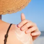 Doktorka upozorava: Ako izgorite na suncu, ne stavljajte jogurt, kiselo mleko i ulje