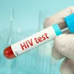 U svetu 40,8 miliona ljudi živi sa virusom HIV-a