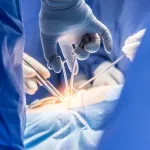 Veliki uspeh hrvatskih lekara: Operacijom koja se i u svetu retko izvodi spasili bebu s tumorom