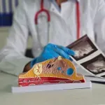 Studija: AI može poboljšati skrining kod žena s visokim rizikom od agresivnog kancera dojke