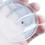 Prvi potvrđeni smrtni slučaj od alergije na hranu povezane sa alfa-gal sindromom