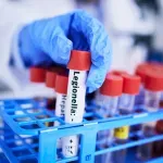 Novi slučaj legionele u Zagrebu, zatvoren bazen u Sportskom parku Mladost