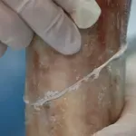 "Bone-02": Koji je domet revolucionarnog kineskog lepka za kosti?