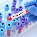 Kako prepoznati manjak progesterona - važnog hormona za funkcionisanje tela