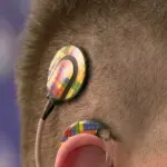 "Pomaže da se vratite normalno u život, u Srbiji postoji otpor zbog dezinformacija": Šta je kohlearna implantacija