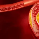 Od ishrane do lekova - šta zaista pomaže kod povišenog LDL-a?