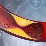 Kardiolog upozorava: Infarkt sve češće pogađa mlađe, rizici u Srbiji među najvišima u Evropi