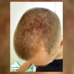 Maloletnika brutalno pretukla grupa tinejdžera: Kako je na to reagovala policija, hitna ga povređenog poslala kući