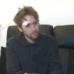 Operisan Lazar Dinić, pretučen tokom izbora 29. marta