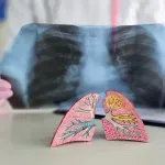 Da li je embolija izlečiva?