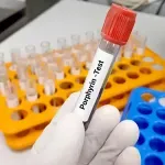 Najsavremeniju terapiju za porfiriju prima svega sedam pacijenata u Srbiji