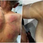 Srpska lista: Kosovska policija upala u kuću Nenada Raškovića, tukla ga, vezala za drvo i tražila da prizna ratni zločin (FOTO)