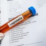 Simptomi koji ukazuju na zarazu legionelom - lečenje može duže da traje