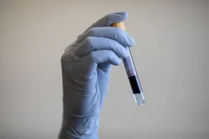 Novi testi: odkrivanje raka v telesu s pomočjo kapljice krvi