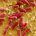 Υγεία: Ζήτημα δημόσιας υγείας η μικροβιακή αντοχή σε βακτήρια που μεταδίδονται μέσω τροφίμων