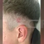 Ξάνθη: 15χρονος μαθητής ξυλοκοπήθηκε άγρια από ομάδα νεαρών – Συμμαθήτριά του έστησε το «ραντεβού» (Βίντεο)