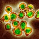 «Σούπερ γρίπη» H3N2 στη Βρετανία: Ραγδαία αύξηση νοσηλειών – Σενάρια για δύσκολο χειμώνα