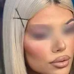 Δυο συλλήψεις για το θάνατο της 19χρονης στο Αργοστόλι, αναζητείται και τρίτο άτομο – Καταγράφηκαν σε βίντεο να την μεταφέρουν